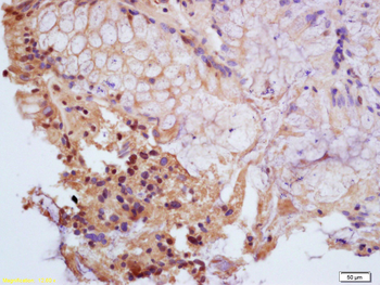 Phospho-PPAR Gamma (Ser112) Rabbit Polyclonal Antibody