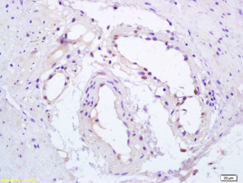 Phospho-PPAR Gamma (Ser112) Rabbit Polyclonal Antibody