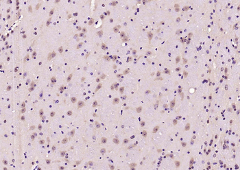 Phospho-AMPK alpha-2 (Thr172) Rabbit Polyclonal Antibody