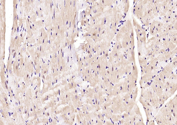 Phospho-AMPK alpha-2 (Thr172) Rabbit Polyclonal Antibody
