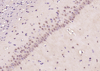 Phospho-AMPK alpha-2 (Thr172) Rabbit Polyclonal Antibody