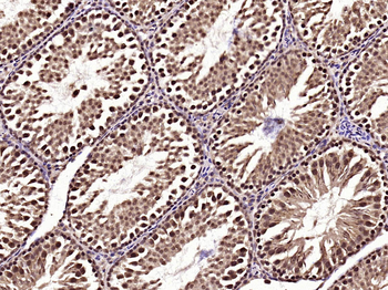 Phospho-AMPK alpha-2 (Thr172) Rabbit Polyclonal Antibody