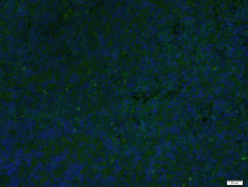 Phospho-ZAP70 (Tyr493) Rabbit Polyclonal Antibody (FITC)