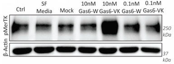 MerTK Tyr749/753/754 Antibody