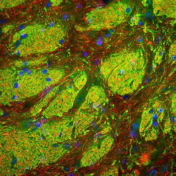 CNP (2,3-cyclic nucleotide-3-phosphodiesterase) Antibody