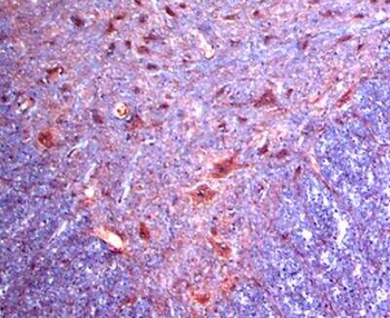 Adrenergic Receptor Alpha 2c Antibody