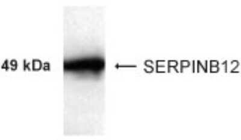 SERPINB12 Antibody