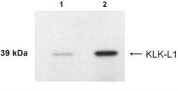 KLK4 Antibody