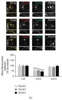 SHANK1a Antibody