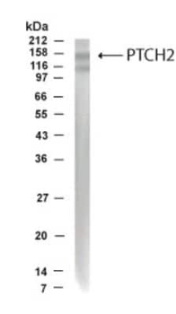 PTCH2 Antibody