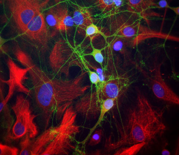 Alpha II Spectrin Antibody