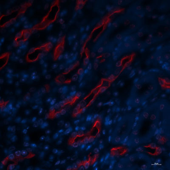 Aquaporin 2 (Ser269) Antibody