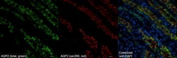 Aquaporin 2 (Ser269) Antibody