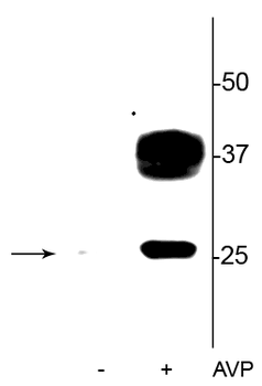 Aquaporin 2 (Ser269) Antibody