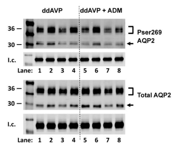 Aquaporin 2 (Ser269) Antibody