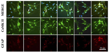 CaM Kinase II (Thr286) Antibody