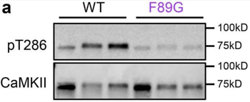 CaM Kinase II (Thr286) Antibody