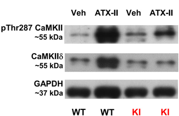 CaM Kinase II (Thr286) Antibody