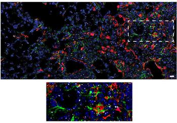Collagen 1, alpha 1 propeptide Antibody