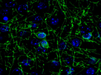 CNP (2,3-cyclic nucleotide-3-phosphodiesterase) Antibody