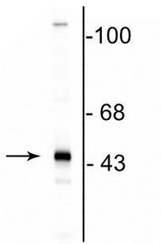CNP (2,3-cyclic nucleotide-3-phosphodiesterase) Antibody