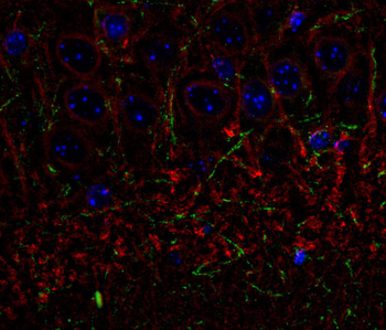 CNP (2,3-cyclic nucleotide-3-phosphodiesterase) Antibody