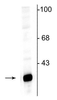 DARPP-32 Antibody