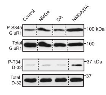 DARPP-32 (Thr34) Antibody