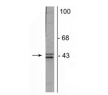 Doublecortin Antibody