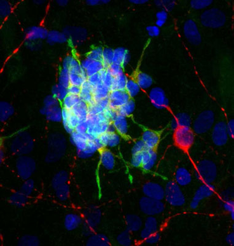 Doublecortin Antibody