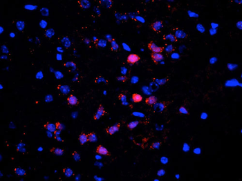 ERK/MAPK (Thr202/Tyr204) Antibody