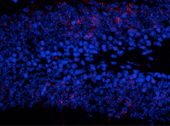 ERK/MAPK (Thr202/Tyr204) Antibody