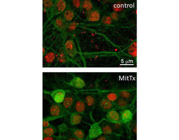 ERK/MAPK (Thr202/Tyr204) Antibody