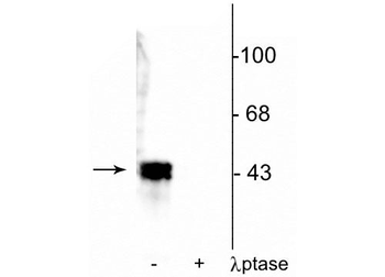 ERK/MAPK (Thr202/Tyr204) Antibody