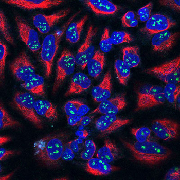 Fibrillarin Antibody