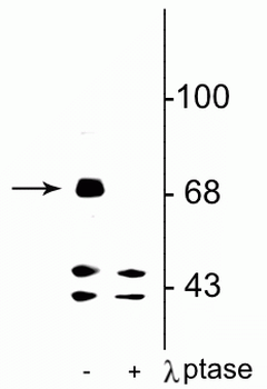 FMRP (Ser499) Antibody