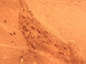 GABAA Receptor α1 Antibody