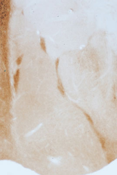 GABAA Receptor α3 Antibody