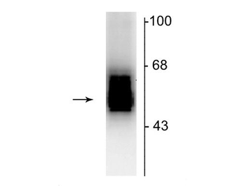 GABAA Receptor ß2 Antibody