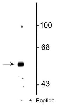 GABAA Receptor, ß3 (Ser408/409) Antibody