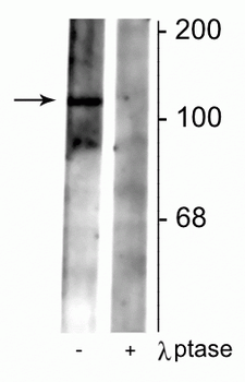 GABAB Receptor (Ser783), R2-Subunit Antibody