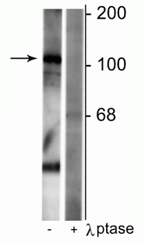 GABAB Receptor (Ser923), R1-Subunit Antibody