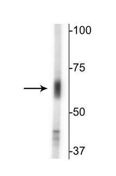 GABA Transporter (GAT) 2 Antibody