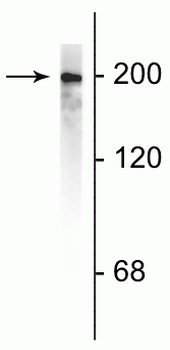 Neurofilament NF-H Antibody