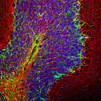 Neurofilament NF-H Antibody