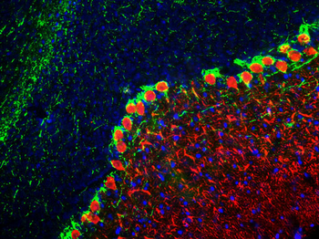 Neurofilament NF-H Antibody