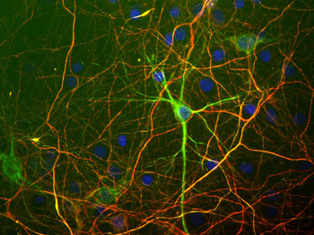 Neurofilament NF-H Antibody