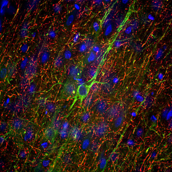 Neurofilament NF-H Antibody