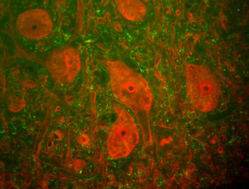 Neurofilament NF-H Antibody