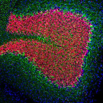 Neurofilament NF-L Antibody